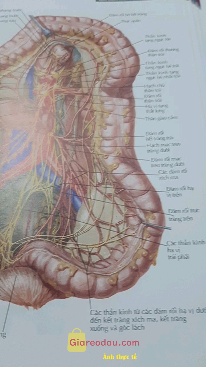 Giảm giá Sách Atlas giải phẫu người (Ấn bản lần thứ 8). Sách dày, nặng, chữ và hình màu sắc rõ nét, giải phẫu chia theo. 